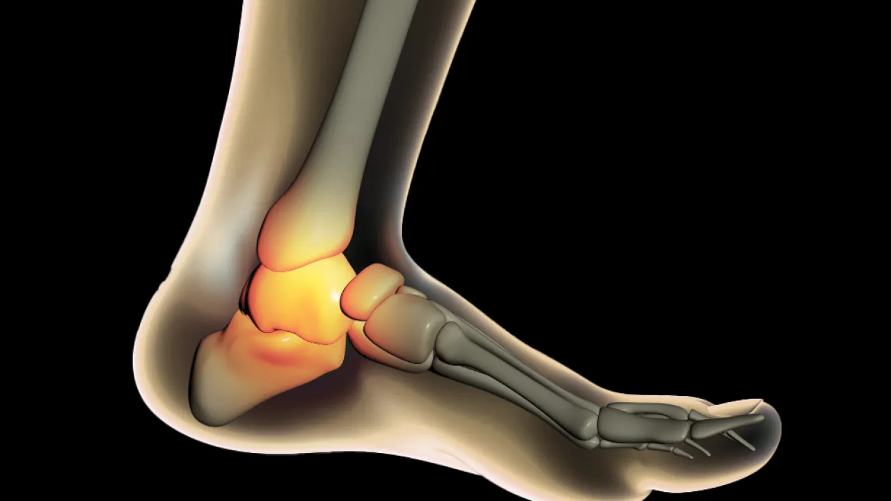 Ayak ve Ayak Bileği Tedavileri