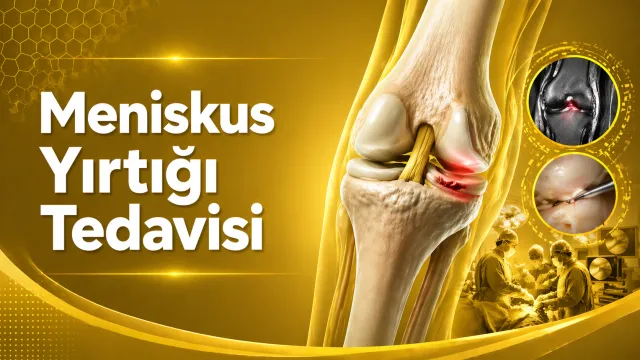 Menisküs Yırtığı Tedavisi