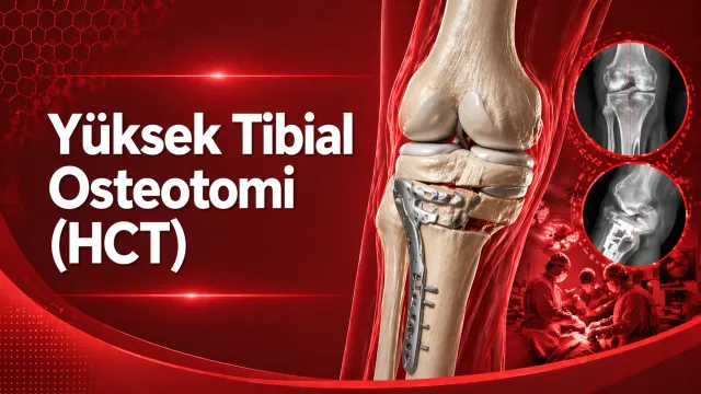 Yüksek Tibial Osteotomi (HTO)