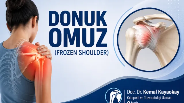 Donuk Omuz (Frozen Shoulder)