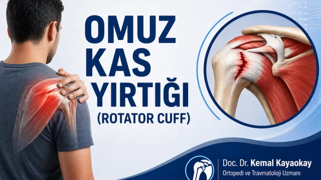 İzmir Omuz Kas Yırtığı (Rotator Cuff) Tedavisi
