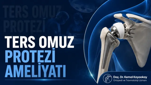 Ters Omuz Protezi Ameliyatı İzmir